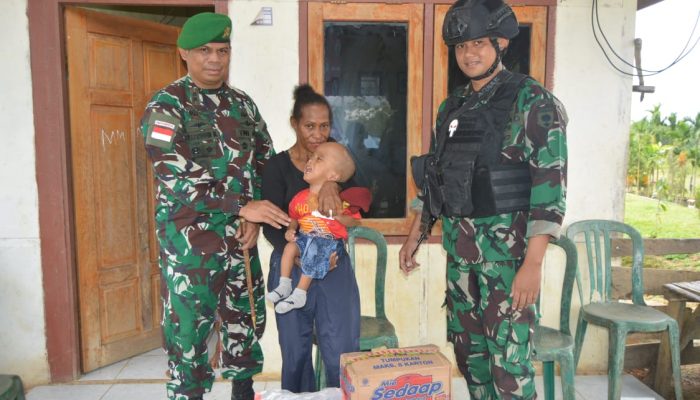 Tak Hanya Perhatian Terhadap Anggota, Dansatgas Yonif 725/Woroagi Peduli Anak Penderita Hidrosefalus