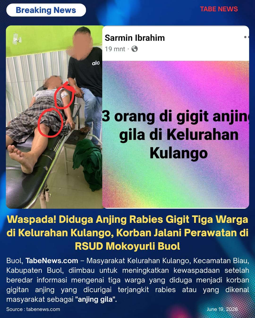 Waspada! Diduga Anjing Rabies Gigit Tiga Warga di Kelurahan Kulango, Korban Jalani Perawatan di RSUD Mokoyurli Buol